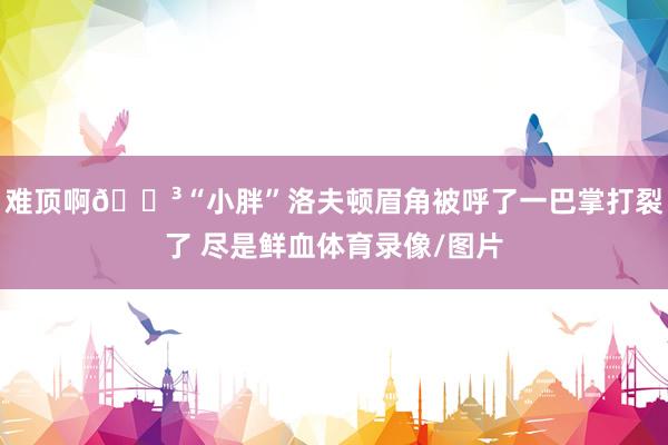 难顶啊😳“小胖”洛夫顿眉角被呼了一巴掌打裂了 尽是鲜血体育录像/图片